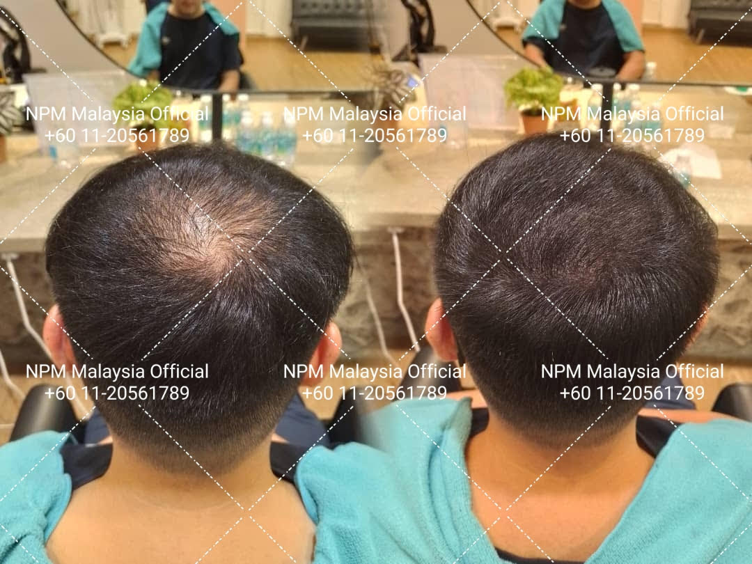 Before and after